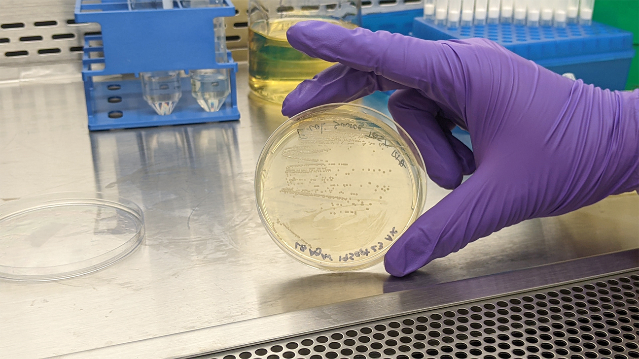 closeup of E. coli culture in microbiology lab